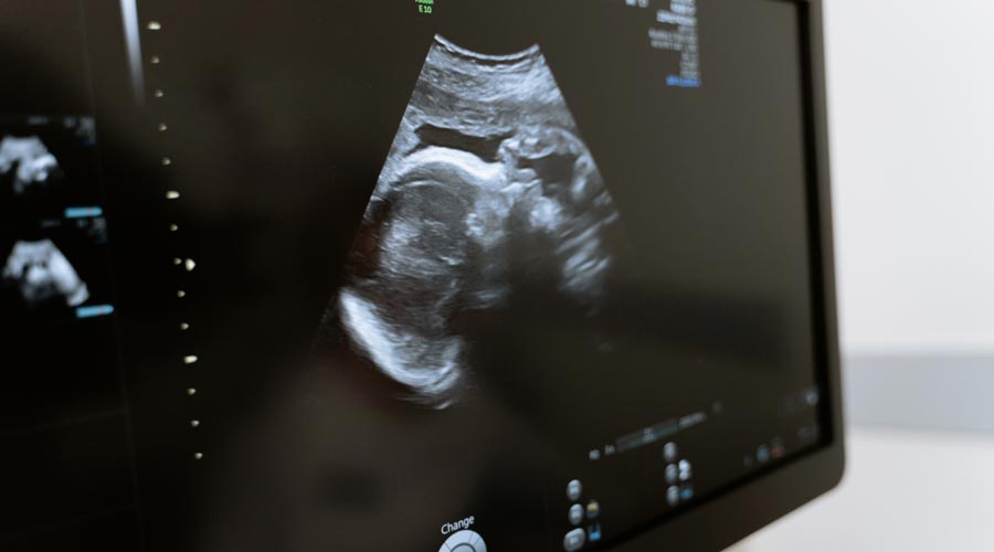 Kinderwunsch – Dein Körper und die Chance auf eine Schwangerschaft